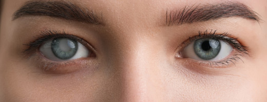 Glaukóm – tichý zlodej zraku